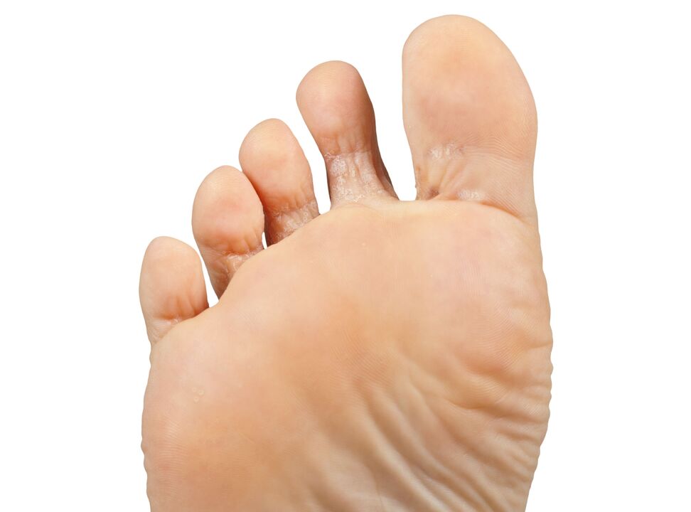 Funger-Good-Pair-y Hectic-Cream-Demyxil